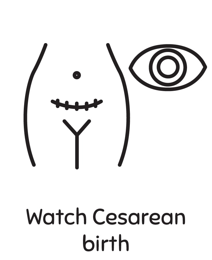 Watch Cesarean Birth
